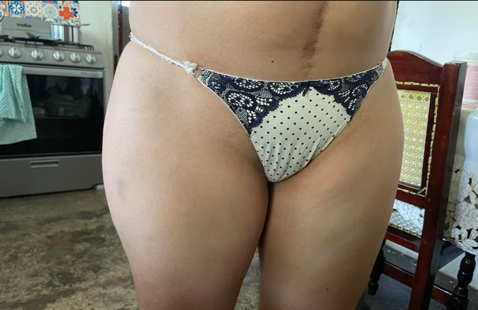 pobrezafilia 2