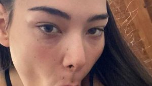 oral pov 6