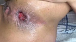 Gabriela prolapse - name'